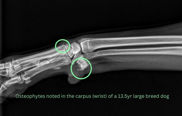 cali osteophytes