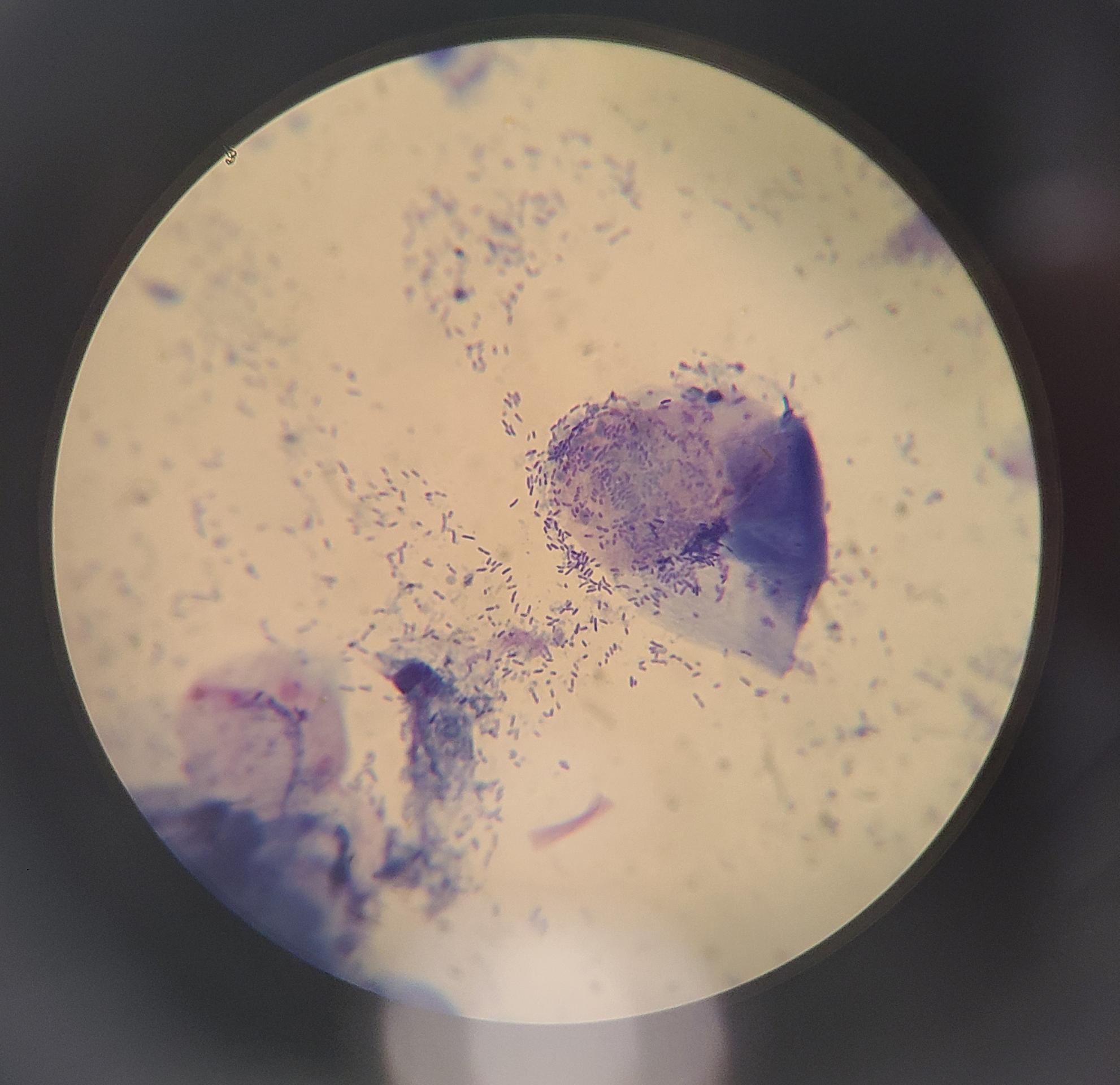 rods ear cytology