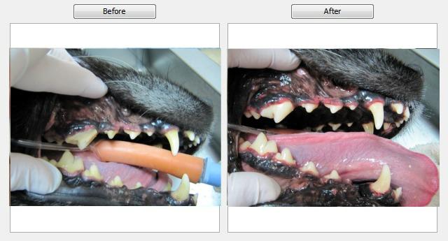 Dental Before & After