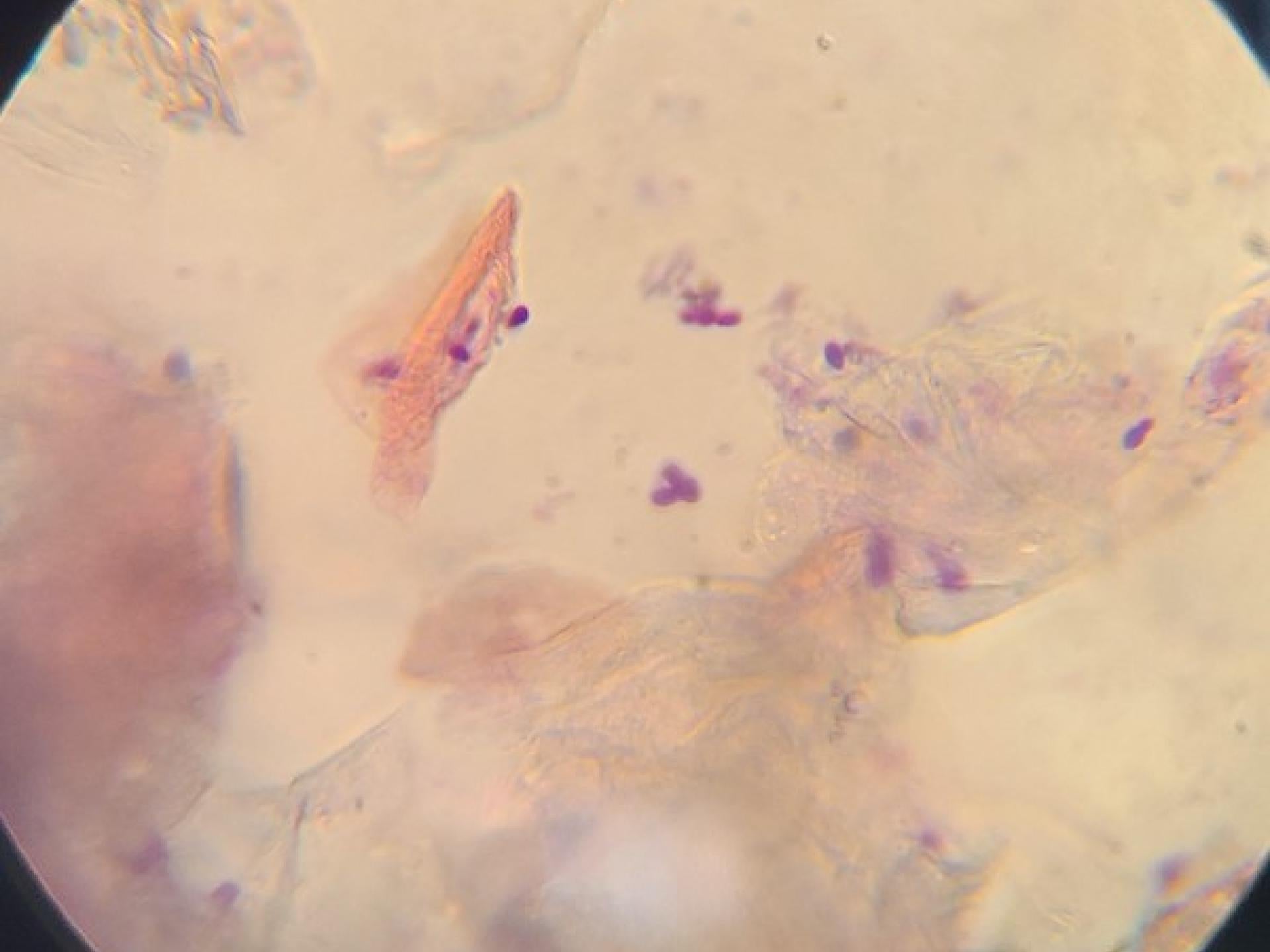 Dermatology 1 Aurora Veterinary Clinic